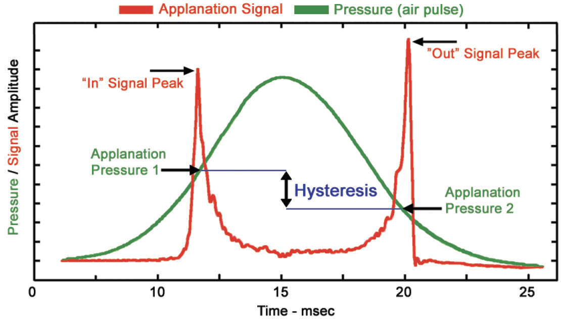 Corneal Biomechanics and Glaucoma - Glaucoma Today