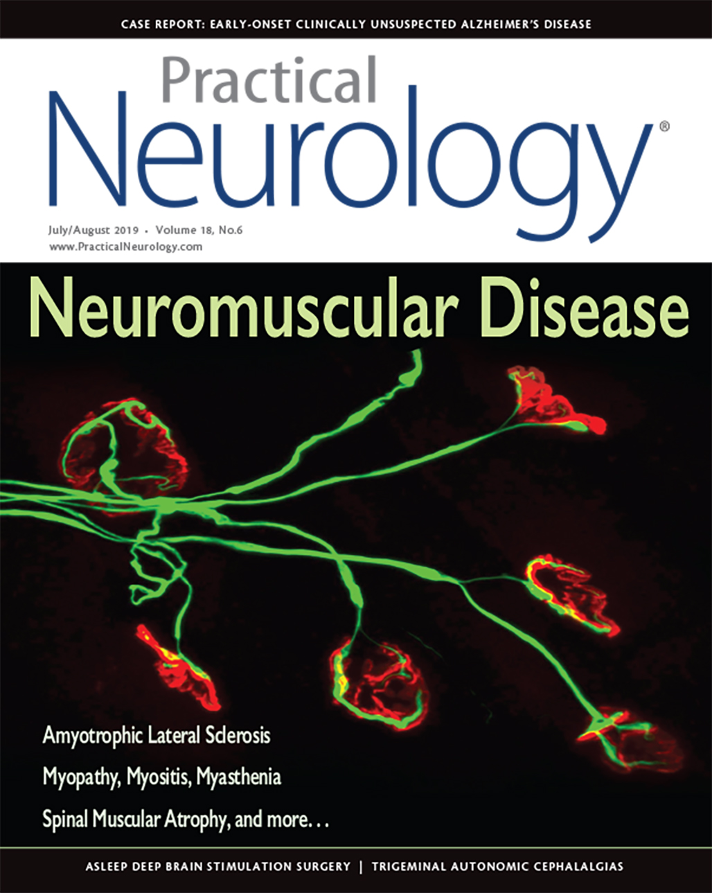 HyperCKemia - Practical Neurology