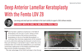 Resource Deep Anterior