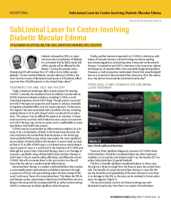 SubLiminal Laser for Center-Involving Diabetic Macular Edema image