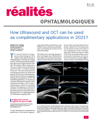 How Ultrasound and OCT can be used as complimentary applications in 2021? image
