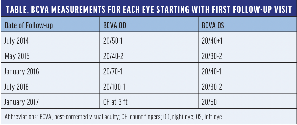 Case NO.2 Tracking Lesion Growth with the ZEISS Retina Workplace