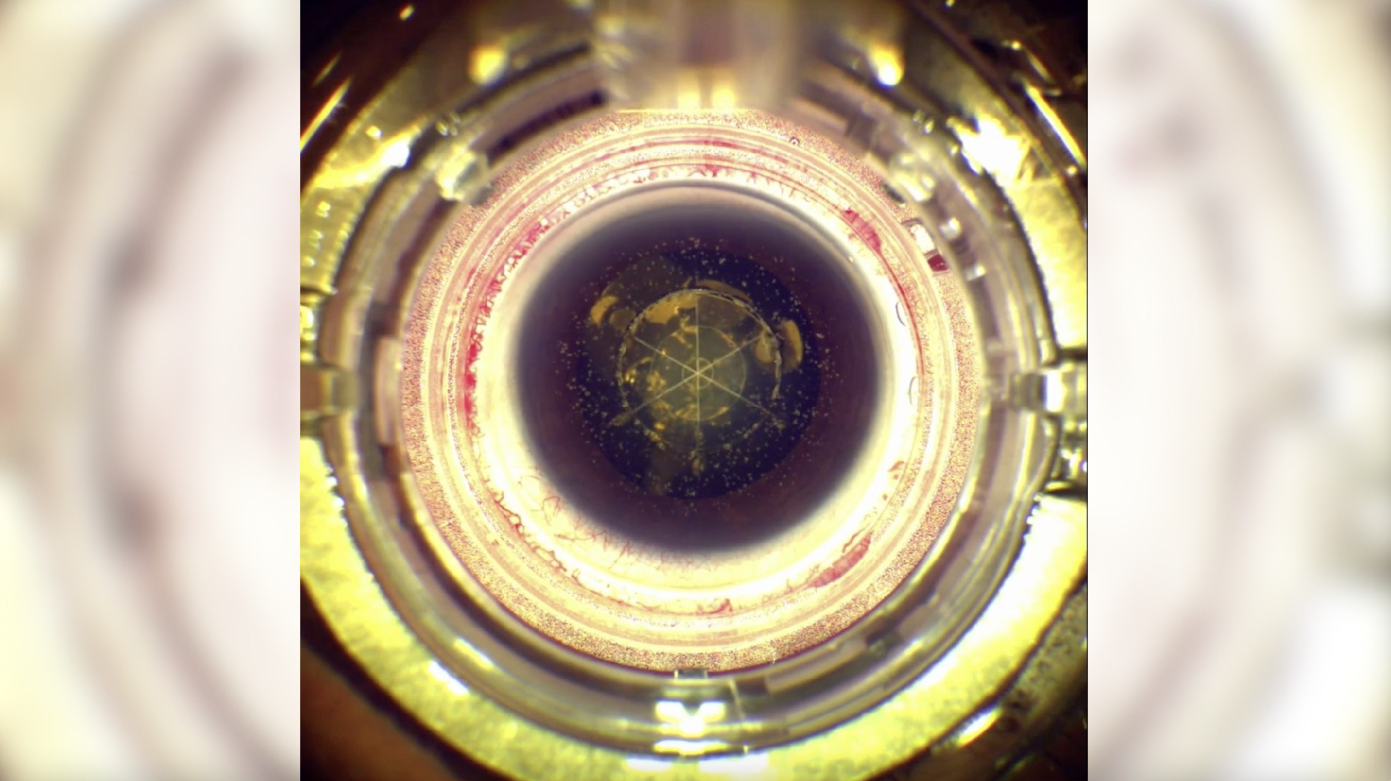 Fragmentation With the ALLY® Adaptive Cataract Treatment System thumbnail