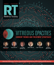 Vitreous Opacities Cover